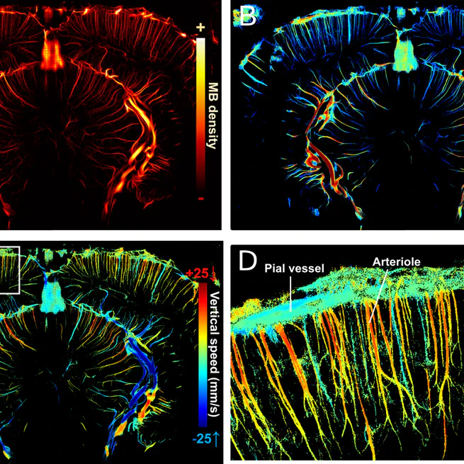 Vascular segmentation of functional ultrasound images using deep learning