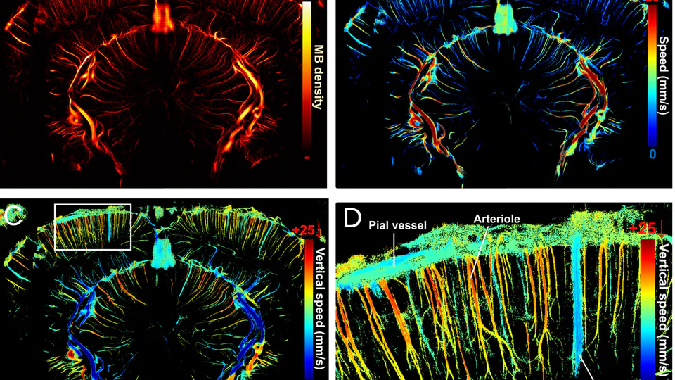 Vascular segmentation of functional ultrasound images using deep learning